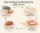 New World Screwworm life cycle, detailing the stages from egg to the flesh-eating parasite in the 2025 outbreak AJH World